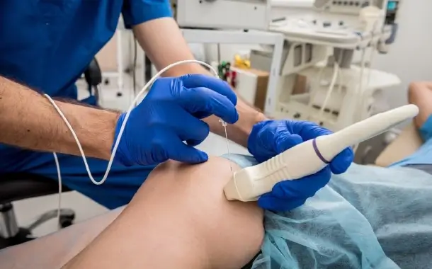 Radiofrequency Ablation (RFA) Procedures